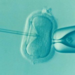 microscope image of IVF treatment